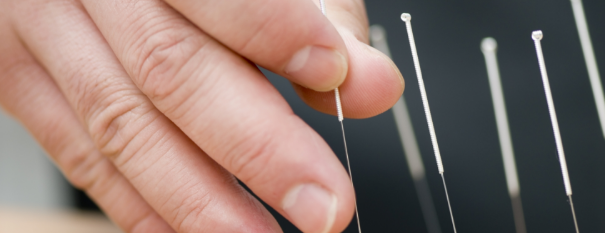 Acupuncture demonstration